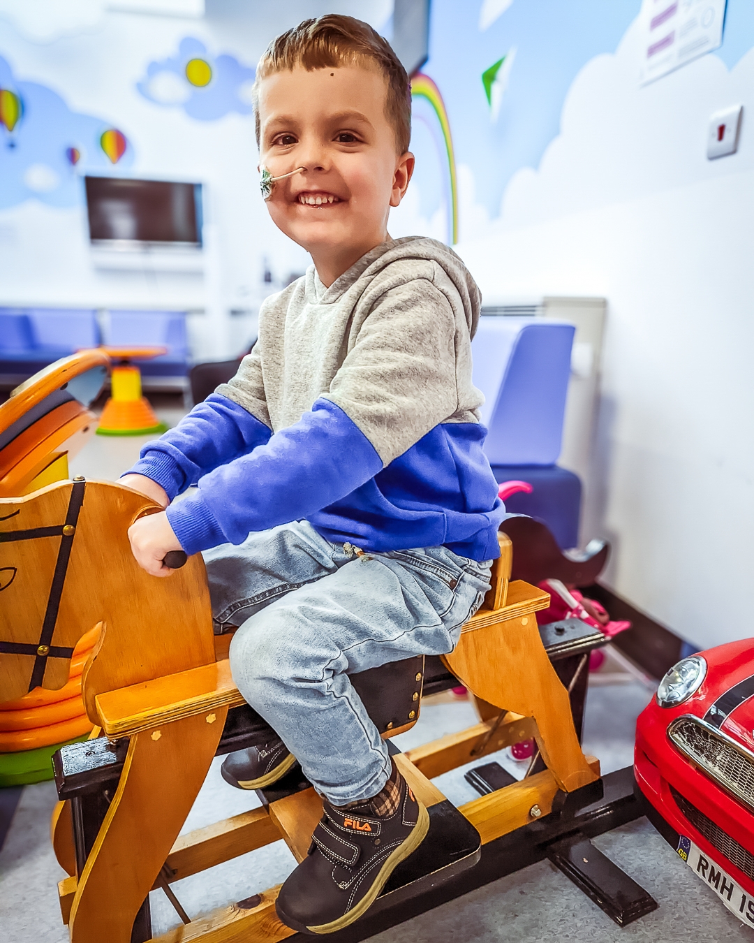 A supported child with a nasogastric tube riding a rocking horse at hospital.