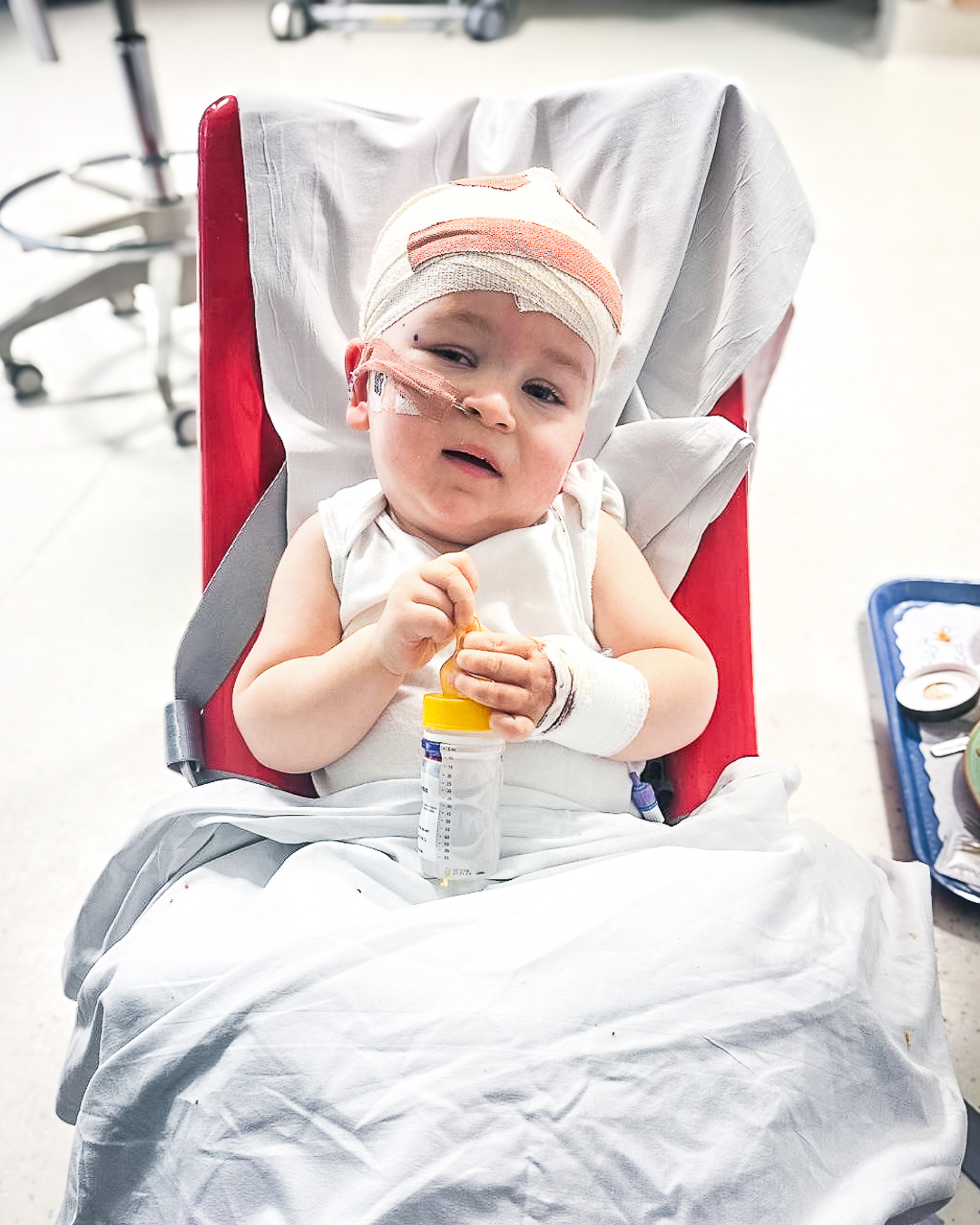 A supported child with a nasogastric tube and a bandage around his head at hospital.